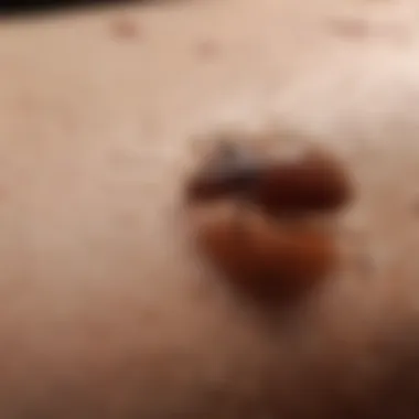 Impact of Bed Bug Bites on Skin Visual representation of bed bug bites on skin